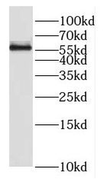 FKTN Rabbit Polyclonal Antibody