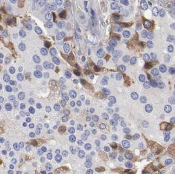 FKTN Rabbit Polyclonal Antibody