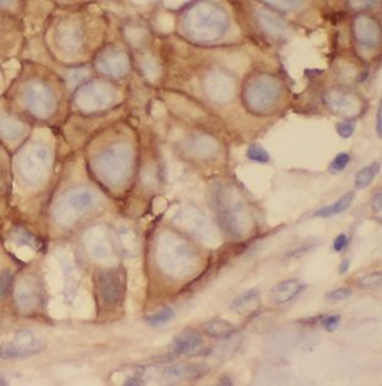 FUT7 Rabbit Polyclonal Antibody