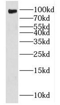 FXR2 Rabbit Polyclonal Antibody