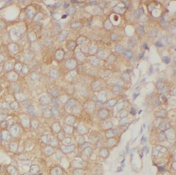 FXYD3 Rabbit Polyclonal Antibody