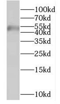 FYTTD1 Antibody