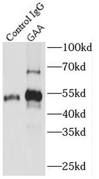 GAA Antibody