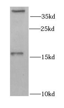 GABARAP Rabbit Polyclonal Antibody
