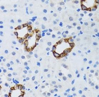 GABARAP Rabbit Polyclonal Antibody