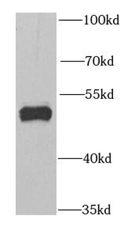 GABPB1 Antibody