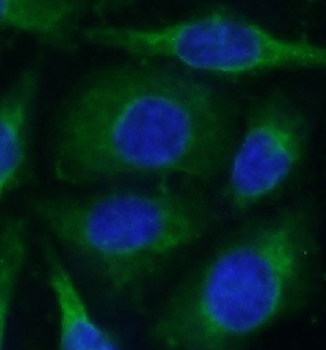 PPP1R15A Antibody