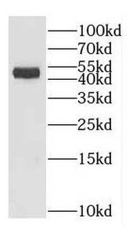 GADL1 Antibody