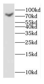 GAGE7 Antibody