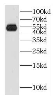 GAL3ST1 Antibody