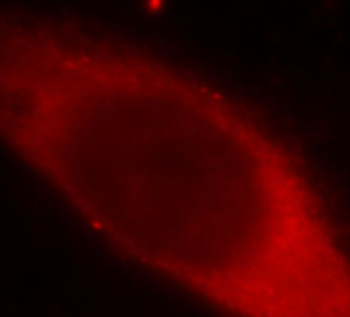 LGALS3 Rabbit Polyclonal Antibody