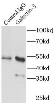 LGALS3 Rabbit Polyclonal Antibody