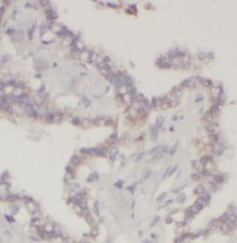 LGALS3 Mouse Monoclonal Antibody