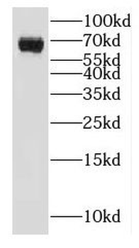 GALNT14 Antibody