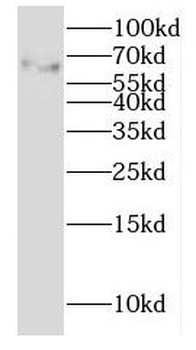GALNT15 Antibody