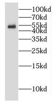 GALNTL5 Antibody