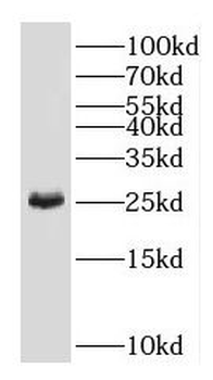 GAMT Antibody