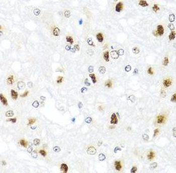 GATA2 Rabbit Polyclonal Antibody
