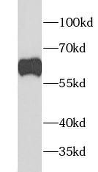 GATA6 Rabbit Polyclonal Antibody