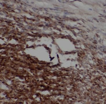 GATA6 Rabbit Polyclonal Antibody