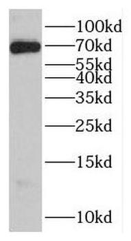 GBP6 Rabbit Polyclonal Antibody