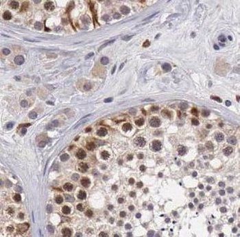 GBP6 Rabbit Polyclonal Antibody