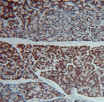 GCAT Rabbit Polyclonal Antibody
