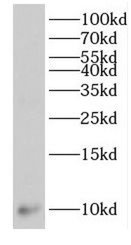 GCHFR Rabbit Polyclonal Antibody