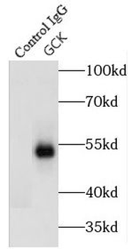 GCK Rabbit Polyclonal Antibody