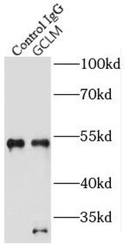 GCLM Rabbit Polyclonal Antibody