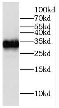 GCLM Rabbit Polyclonal Antibody