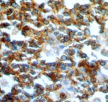 GCNT2 Rabbit Polyclonal Antibody