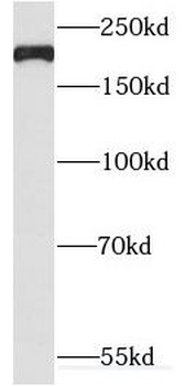 TUBGCP6 Antibody