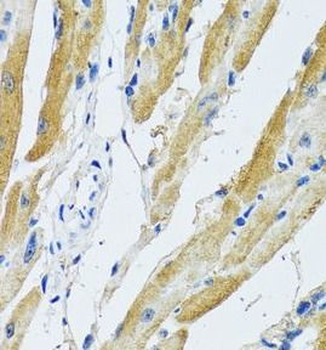 GDAP1 Rabbit Polyclonal Antibody