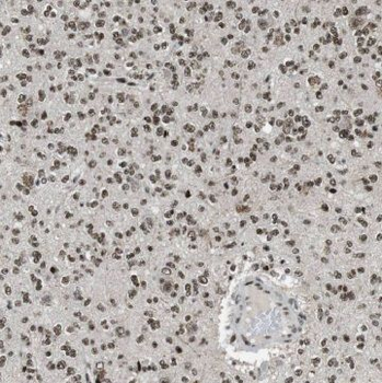 GDAP1L1 Rabbit Polyclonal Antibody