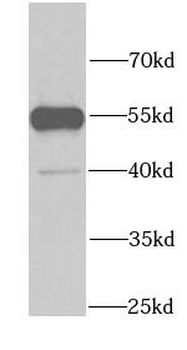 GDI1 Antibody