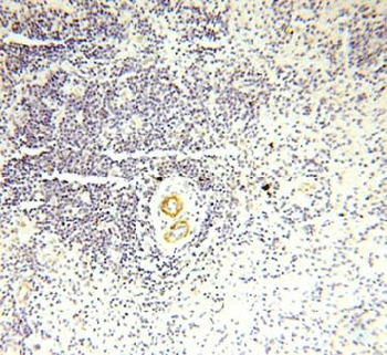 GDPD5 Rabbit Polyclonal Antibody