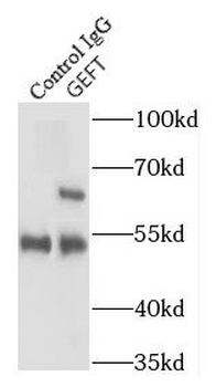 ARHGEF25 Antibody
