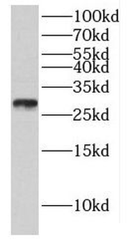 GMNN Rabbit Polyclonal Antibody