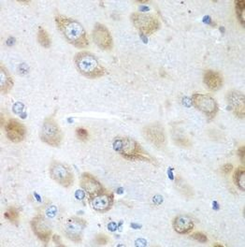 GFM1 Rabbit Polyclonal Antibody