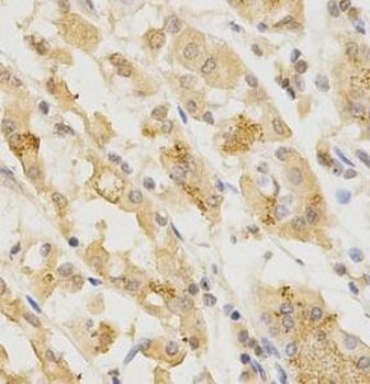 GGA2 Rabbit Polyclonal Antibody
