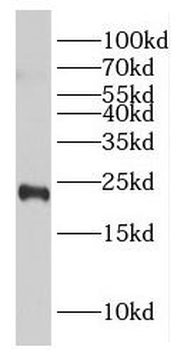 GGCT Antibody