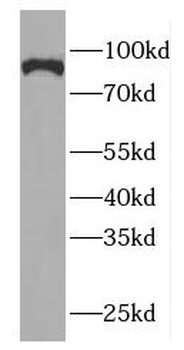 GGCX Rabbit Polyclonal Antibody