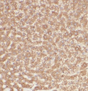 GGCX Rabbit Polyclonal Antibody