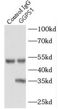 GGPS1 Antibody