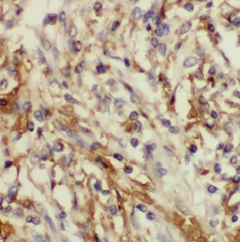 GGT7 Rabbit Polyclonal Antibody