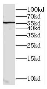 GHDC Rabbit Polyclonal Antibody