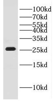 GHITM Antibody