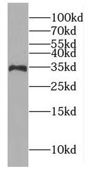 GIMAP7 Rabbit Polyclonal Antibody