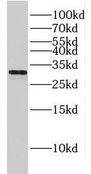 GJB3 Antibody